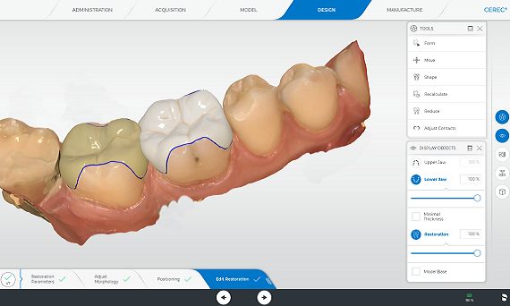 CEREC Teknolojisi Nedir? Dijital Diş Hekimliğinde Yeni Dönem